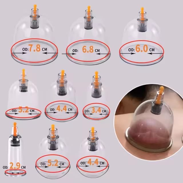 Ordering Wholesale Hijama Cups