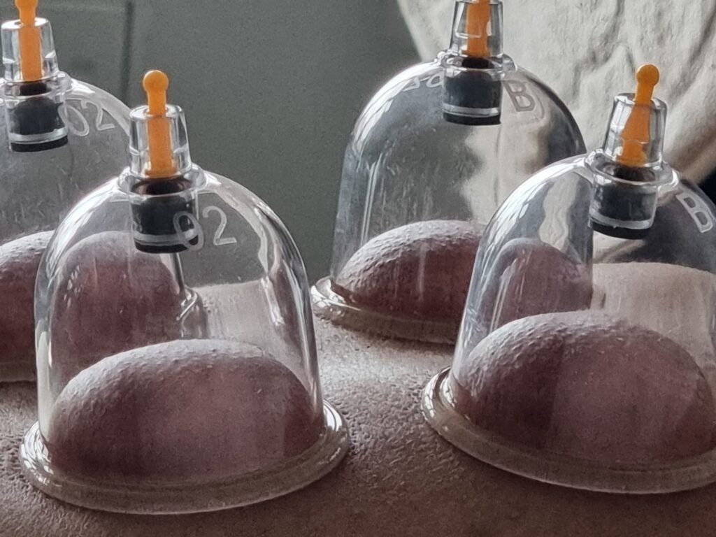 Hijama therapy b2 size cups showing strong suction dry cupping wholesale