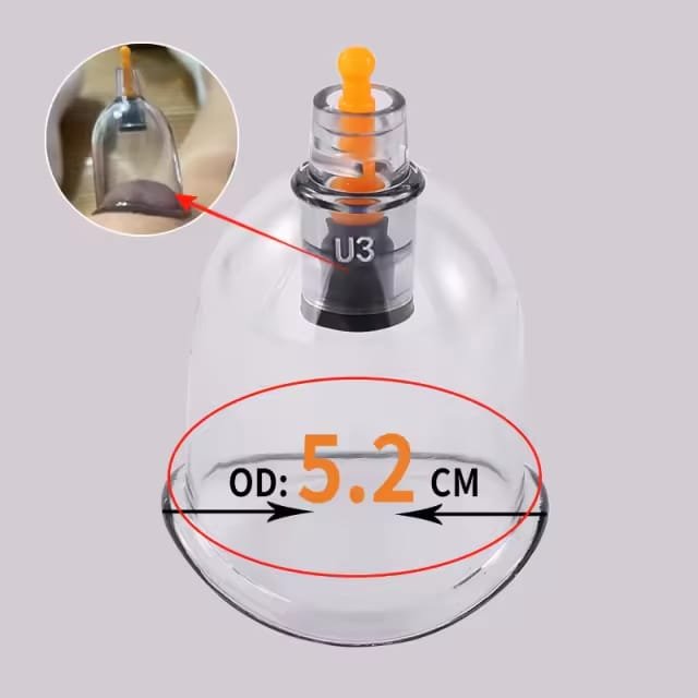 Ordering Wholesale Hijama Cups